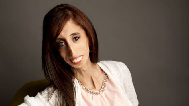 Lizzie Velasquez