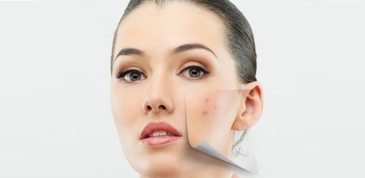 Vị trí của mụn nói gì về cơ thể bạn