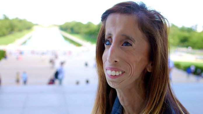 Lizzie Velasquez