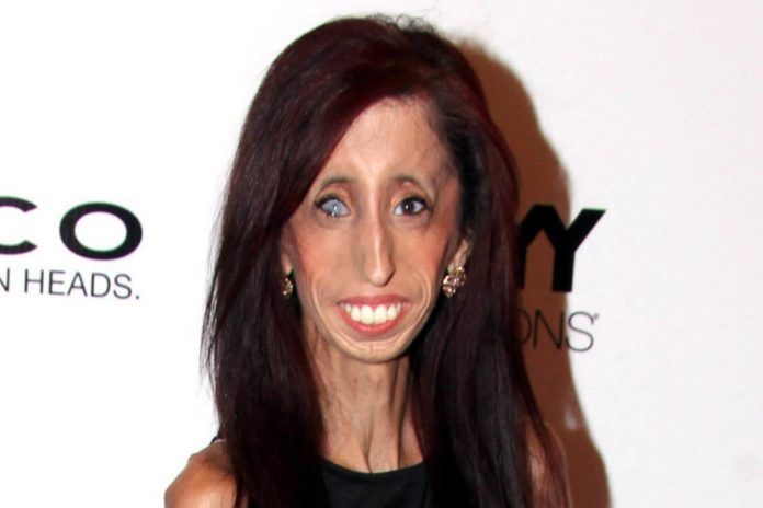 Lizzie Velasquez