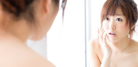 Lỗ chân lông to một phần lớn là do di truyền (Ảnh: internet)