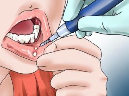 bệnh nhiệt miệng