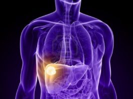 8 dấu hiệu ung thư gan giai đoạn đầu bạn không nên bỏ qua dấu hiệu ung thư gan