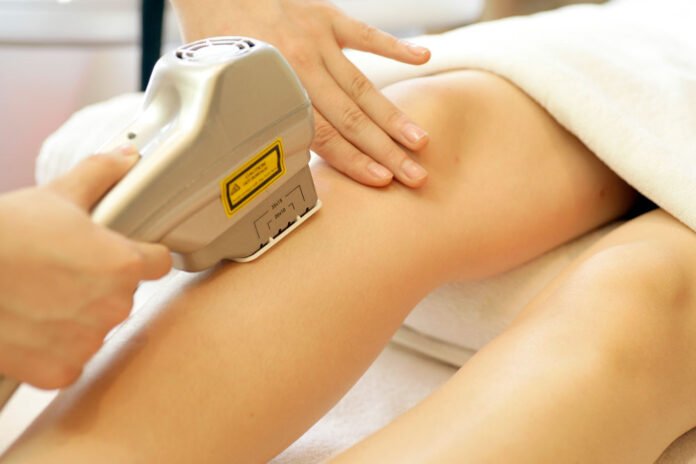 Triệt lông laser có thể dùng với mọi vùng da trên cơ thể (Nguồn: Internet)