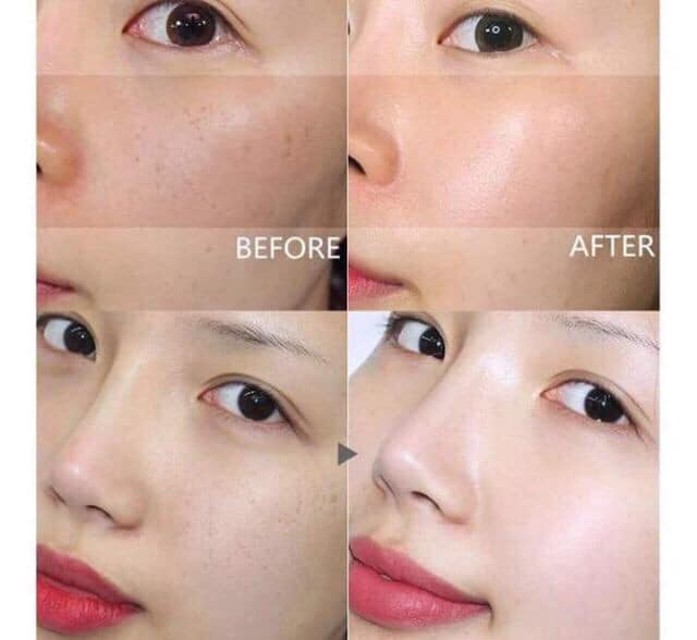 Sản phẩm trị nám hiệu quả và dưỡng da trắng sáng (ảnh: internet).