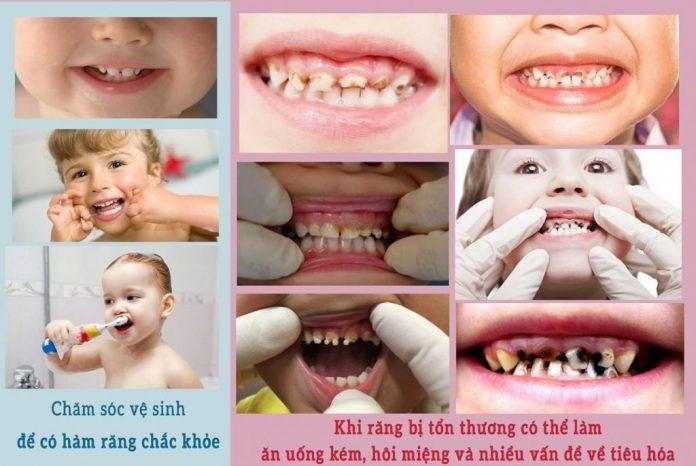 chải răng đúng cách (Nguồn: Internet) 