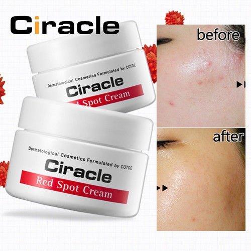 Kem Ciracle Red Spot Cream có tác dụng trị mụn, làm mờ vết thâm hiệu quả (ảnh: internet).