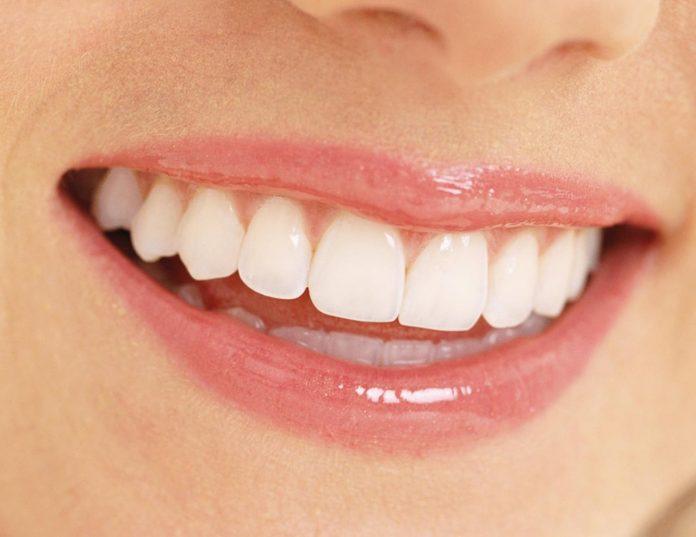 Một hàm răng trắng và đều sẽ giúp bạn có một nụ cười tỏa nắng. (Nguồn: internet).