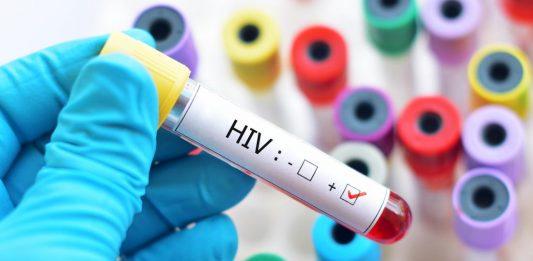 hiv lây nhiễm