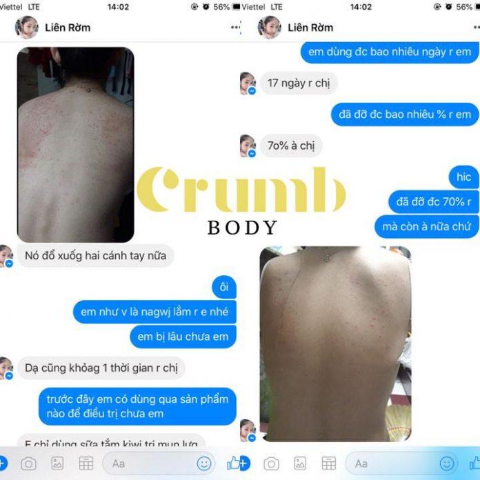 Review bộ sản phẩm đặc trị mụn lưng và viêm nang lông Crumb Body tạm