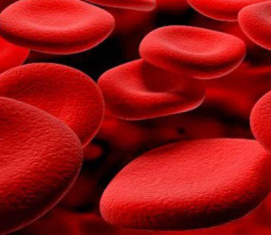 Thalassemia