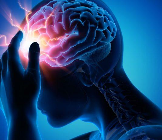 Tai biến mạch máu não