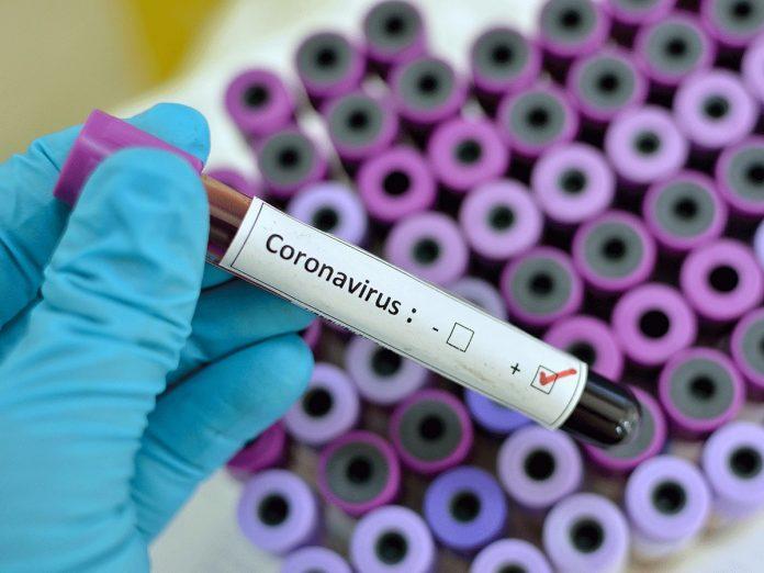 coronavirus-test