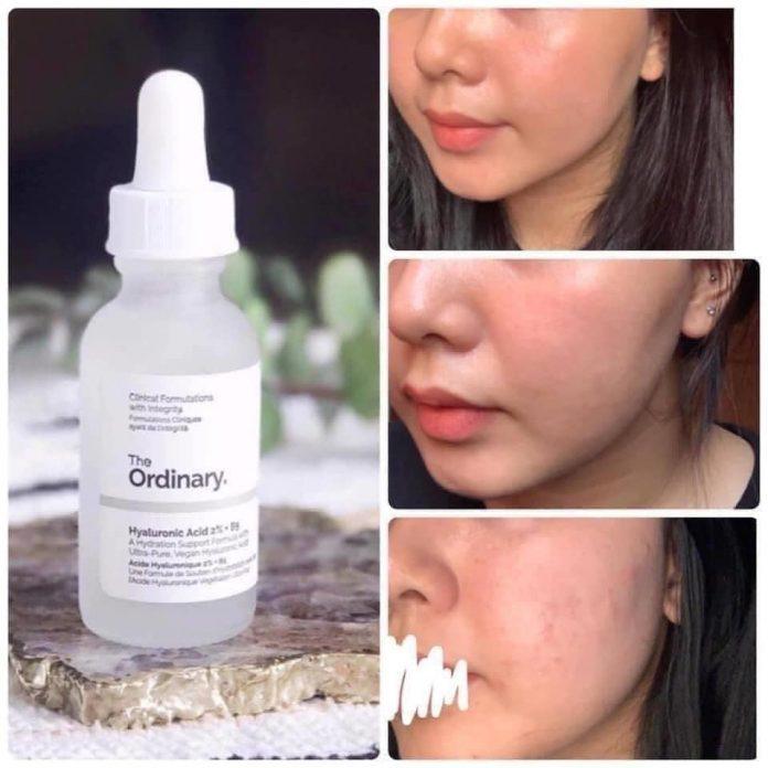 Review The Ordinary Hyaluronic Acid 2% + B5 Serum của khách hàng đã sử dụng trên Facebook. (NguoofnL BlogAnChoi)