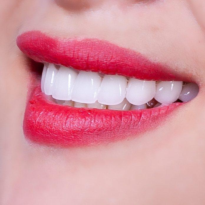 Hàm răng trắng sáng luôn thu hút mọi ánh nhìn ( Nguồn: Internet )