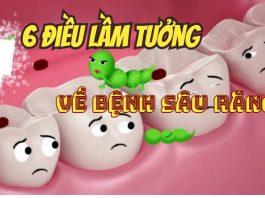 Vì sao bạn bị sâu răng? 6 sự thật bất ngờ mà bạn nên biết về căn bệnh cực kỳ dễ mắc này!