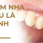 Bệnh nha chu là gì? Những điều bạn cần biết về nhóm bệnh thường gặp này