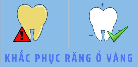 Làm thế nào để khắc phục tình trạng răng xỉn màu ngay tại nhà ?