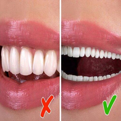 Bạn nghĩ sao về hàm răng này? (Ảnh: Internet)