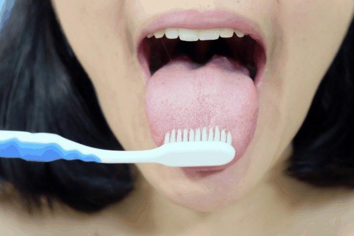 Vệ sinh lưỡi là một phần quan trọng nhưng ít người để ý khi đánh răng (Ảnh: Internet).