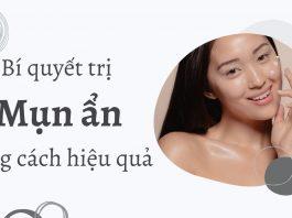 Bí quyết trị mụn ẩn với hoạt chất hiệu quả (Nguồn: Internet).