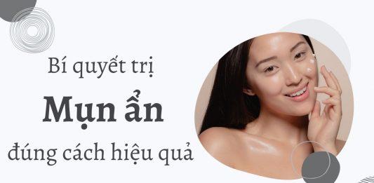 Bí quyết trị mụn ẩn với hoạt chất hiệu quả (Nguồn: Internet).