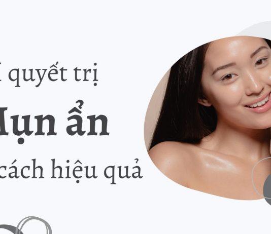 Bí quyết trị mụn ẩn với hoạt chất hiệu quả (Nguồn: Internet).