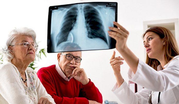 Người già mắc ung thư phổi vẫn có thể được điều trị khỏi (Ảnh: Internet).