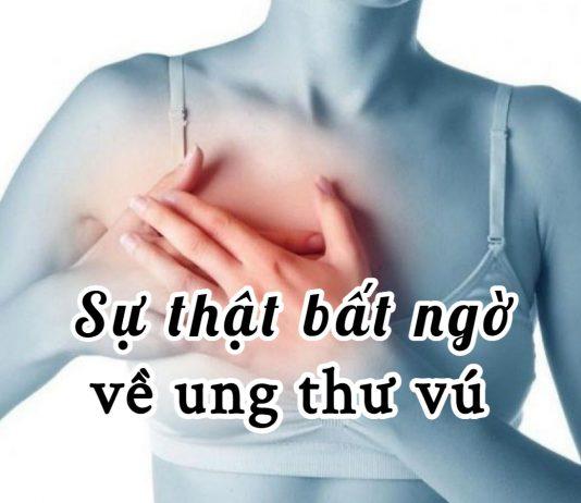 11 quan niệm sai lầm về ung thư vú – căn bệnh cực kỳ nguy hiểm nếu không được phát hiện kịp thời!