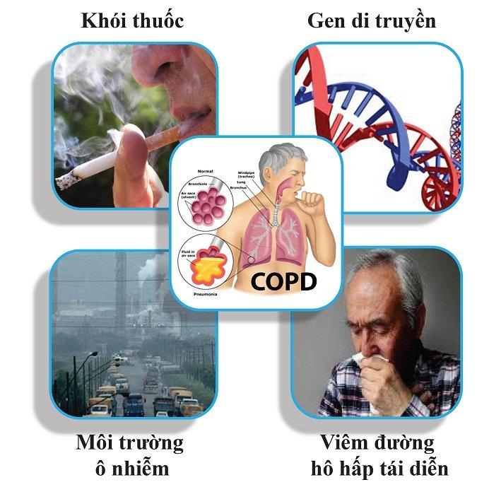 Nhiều yếu tố khác có thể làm tăng nguy cơ mắc COPD (Ảnh: Internet).