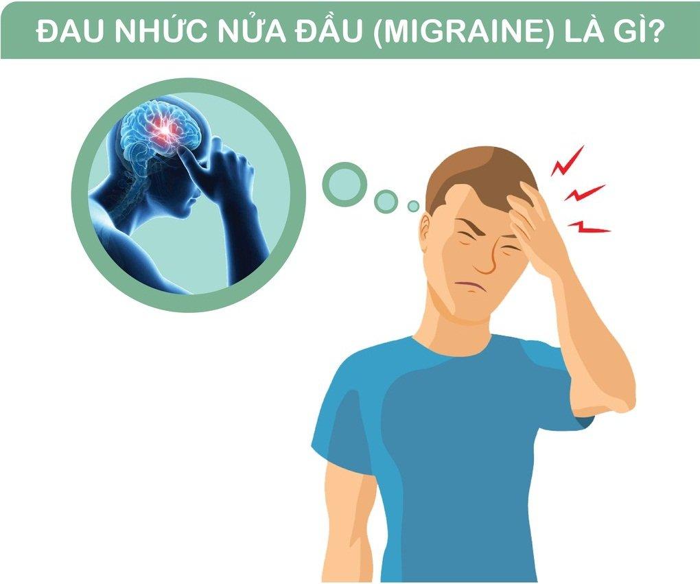 Đau đầu migraine ảnh hưởng rất nhiều đến chất lượng cuộc sống (Ảnh: Internet).