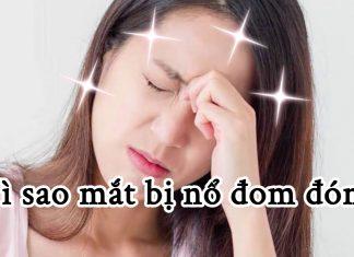 Hiện tượng “nổ đom đóm mắt” có nguyên nhân do đâu? Liệu có phải là bệnh lý nguy hiểm?