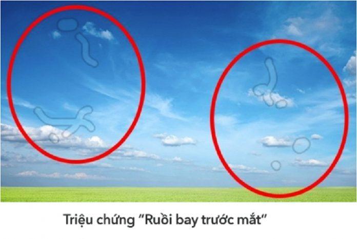 Những đốm mờ còn được gọi là "ruồi bay" (Ảnh: Internet).