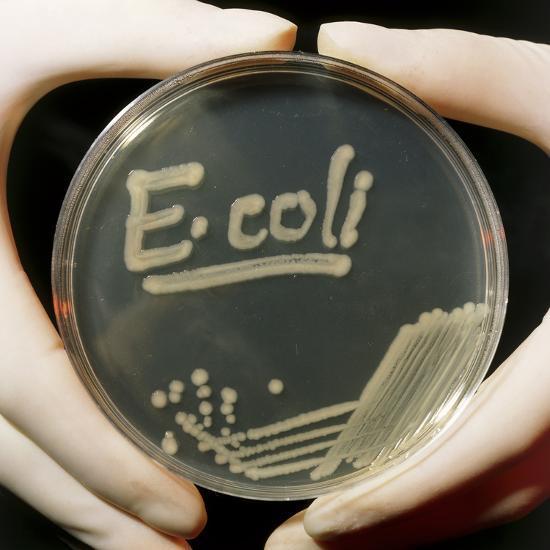 Cấy mẫu phân để tìm vi khuẩn E. coli (Ảnh: Internet).