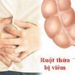 8 điều bạn cần biết về viêm ruột thừa – Nguyên nhân cần nghĩ tới khi bị đau bụng cấp tính!