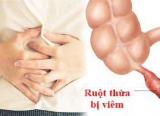 8 điều bạn cần biết về viêm ruột thừa – Nguyên nhân cần nghĩ tới khi bị đau bụng cấp tính!