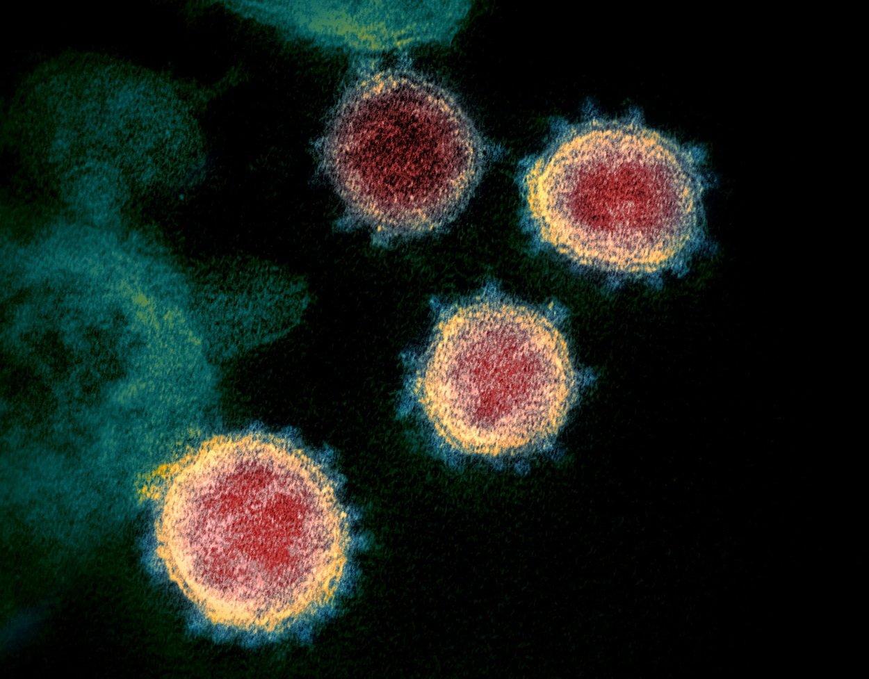 Ảnh chụp virus SARSS-CoV-2 qua kính hiển vi điện tử (Ảnh: Internet).