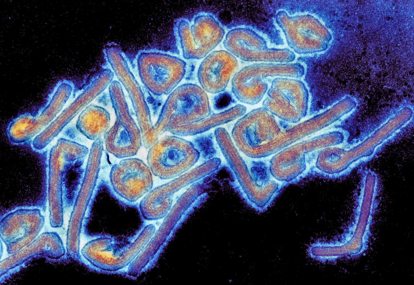 Ảnh chụp virus Marburg dưới kính hiển vi điện tử (Ảnh: Internet).