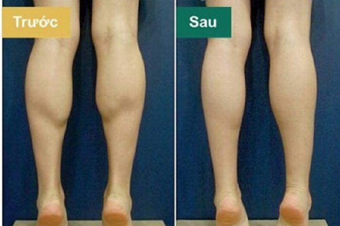 Kiễng chân giúp giảm mỡ bắp chân (Ảnh: Internet).