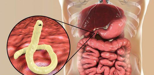 Bệnh giun đũa và nguy cơ lây nhiễm tiềm tàng