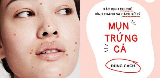 Sẹo mụn do mụn trứng cá: Nguyên nhân, cách điều trị và phòng ngừa