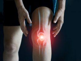 Viêm khớp có những loại nào? Nguyên nhân, triệu chứng, cách điều trị và phòng ngừa