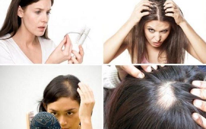 Rụng tóc ảnh hưởng xấu đến tâm lý của cả nam và nữ (Ảnh: Internet).