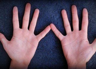 Bàn tay cũng có thể cảnh báo bệnh tật: Hãy để ý những dấu hiệu này!