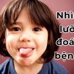 Nhìn lưỡi cũng đoán được bệnh? Lưỡi trắng, lưỡi đỏ, lưỡi đen là bệnh gì?