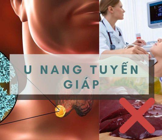 u nang tuyến giáp