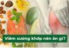 Bệnh viêm xương khớp nên ăn gì và tránh ăn gì để bảo vệ sụn khớp?