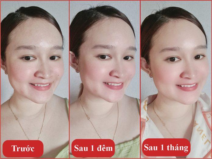 Hiệu quả mang lại trên da sau khi sử dụng kem dưỡng Meder Circa-Night Cream trên da (Nguồn: internet)