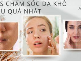 Bật mí các tips chăm sóc da khô hiệu quả nhất (nguồn: BlogAnChoi)