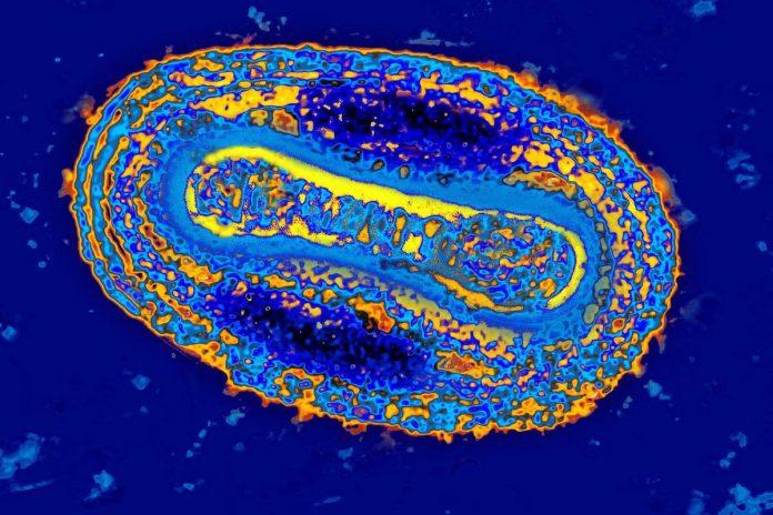 Virus đậu mùa nhìn dưới kính hiển vi điện tử (Ảnh: Internet).